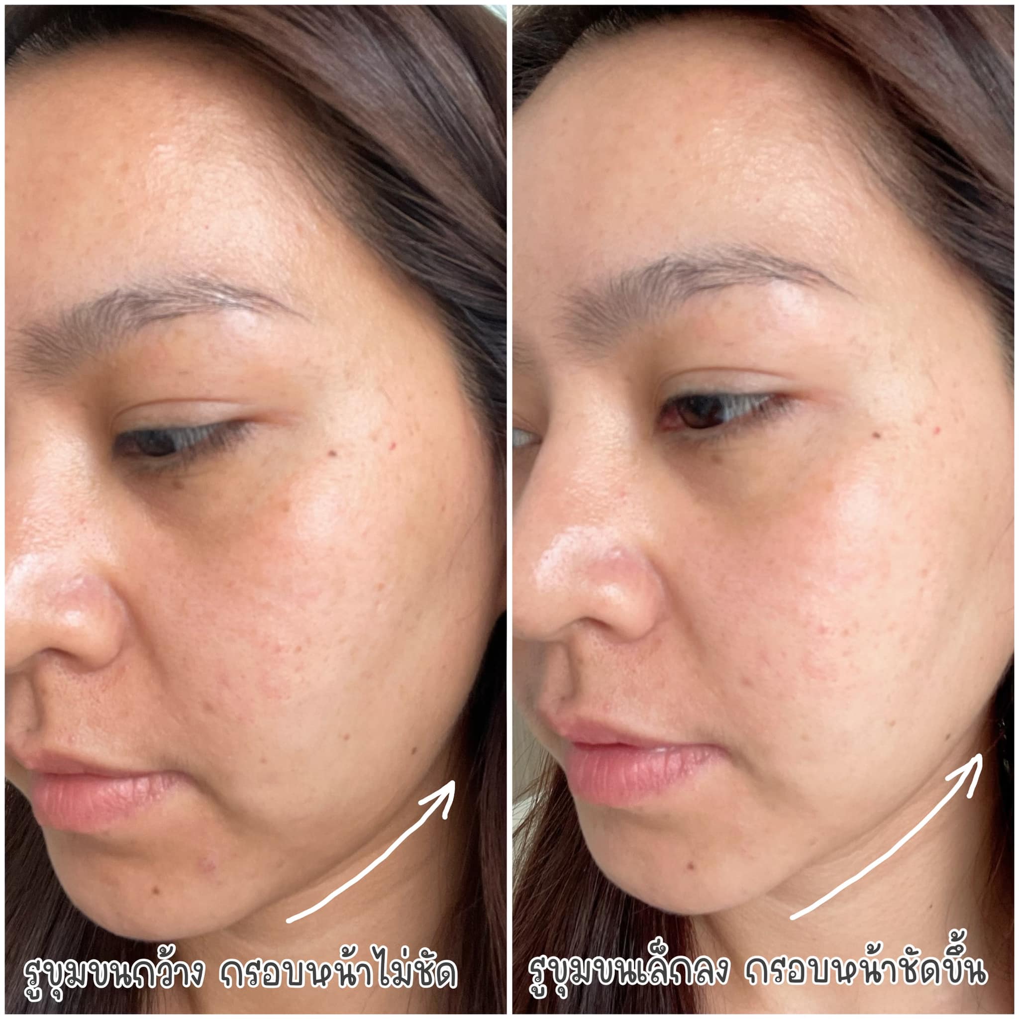 ครส. สตอรี่-Claryssa’s story